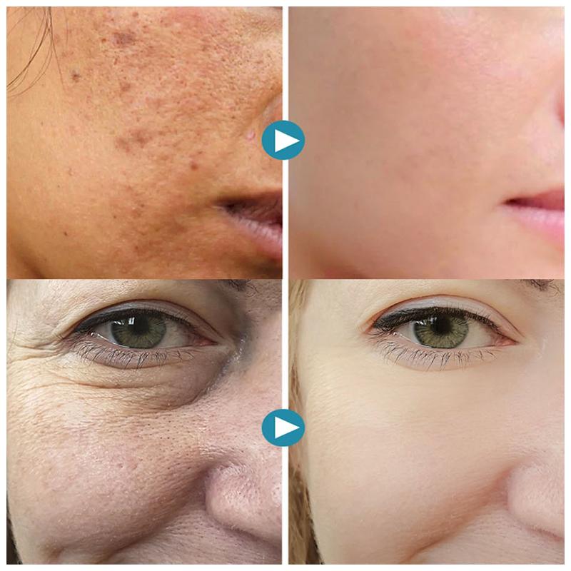 Silky Soft Gentle Skin Care