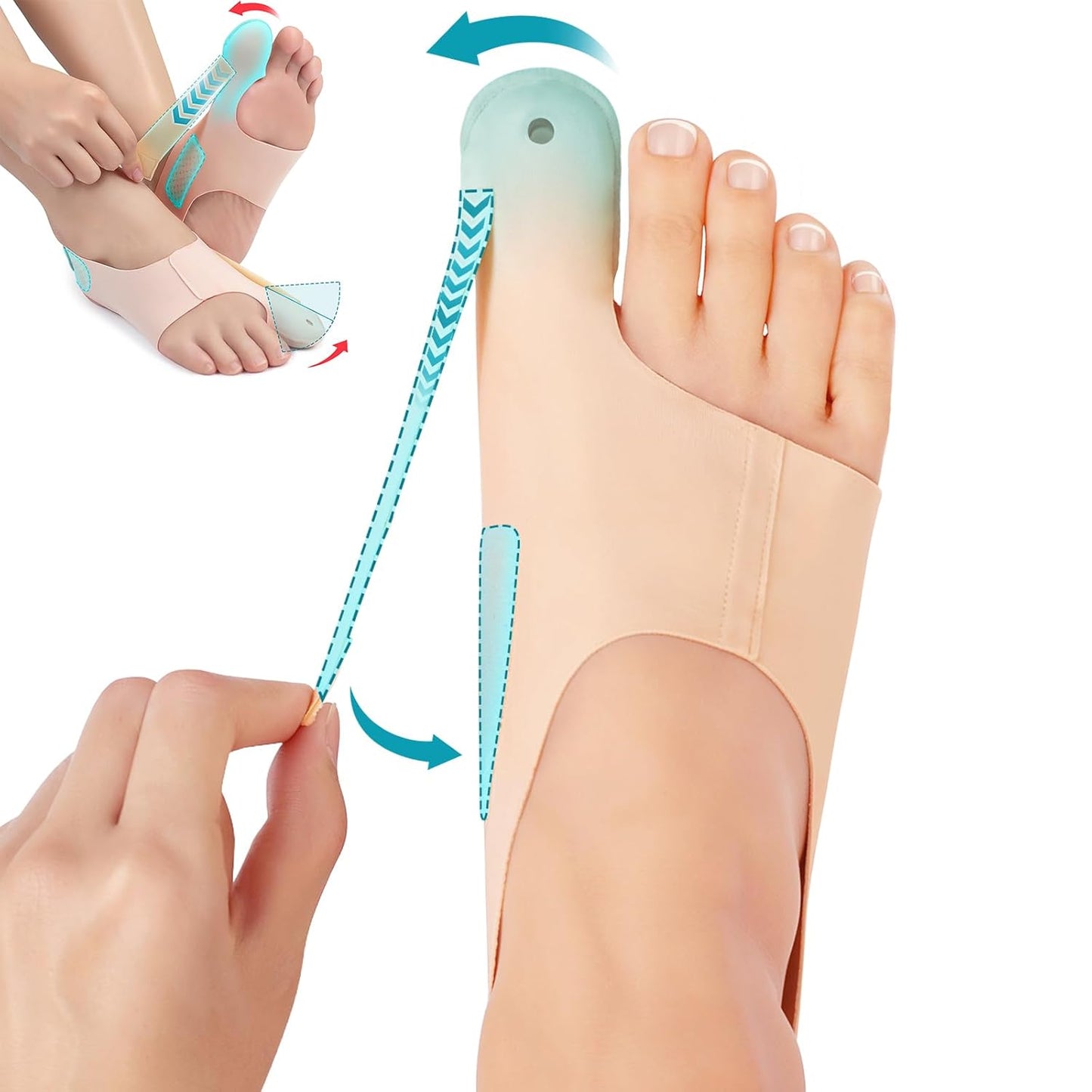 Orthopedic Shoe Insoles for Hallux Valgus Pain Relief