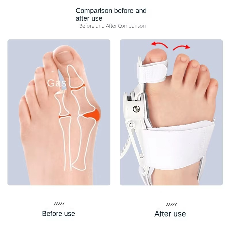 Comfortable Befez Arch Support Insoles