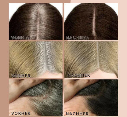 Easy Hairline Hairband