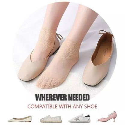 Befez | Women's Elegant Lace Ankle Socks