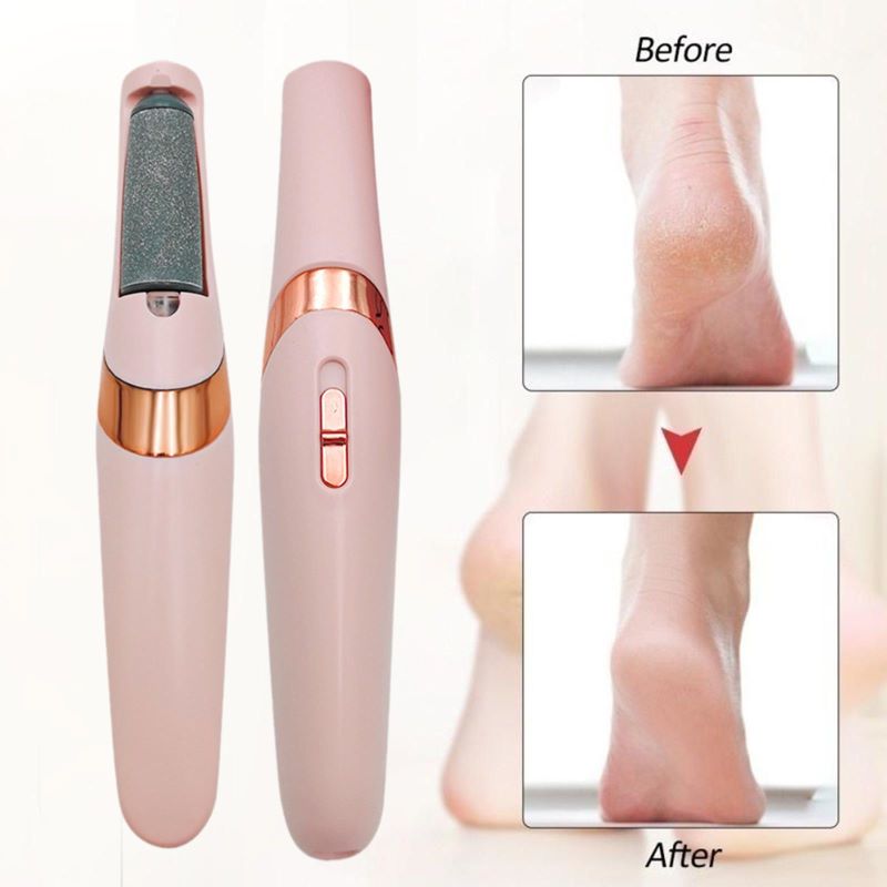 Effective Foot Callus Remover Tool Befez - Befez