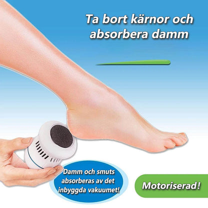 Befez Foot Smoother - Callus Scrubber