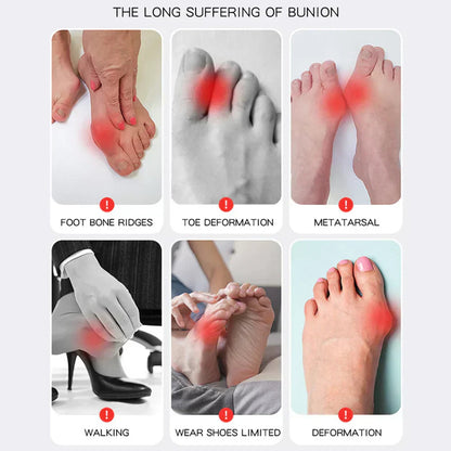 Orthopedic Shoe Insoles for Hallux Valgus Pain Relief