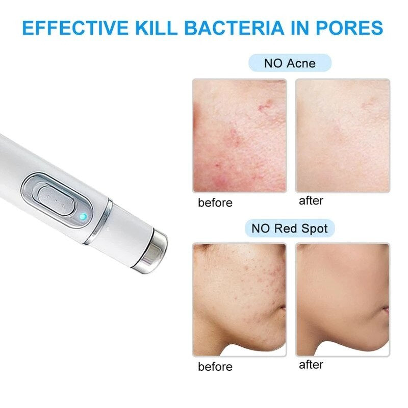 Professional Facial Skin Tightening Device