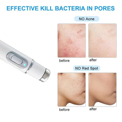 Professional Facial Skin Tightening Device