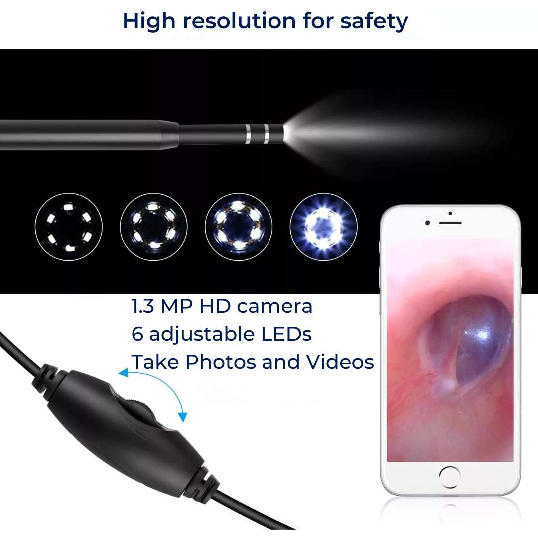 Advanced Ear Scope with HD Camera and Wax Removal
