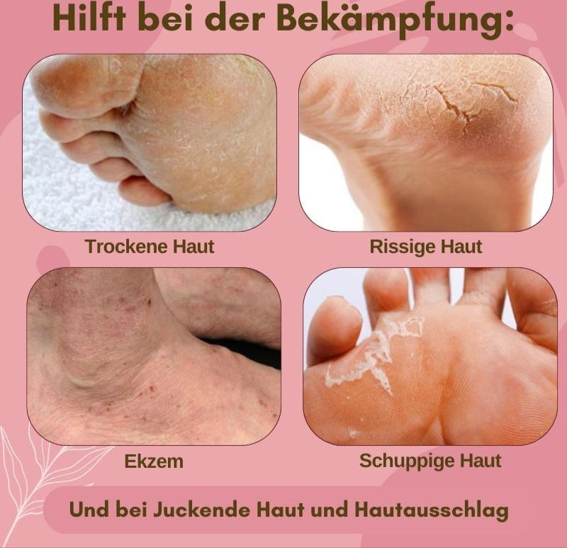 Fast Healing Foot Cream for Dry Itchy Feet