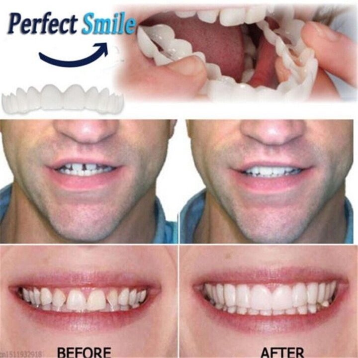 Comfortable Custom Fit Dental Plates