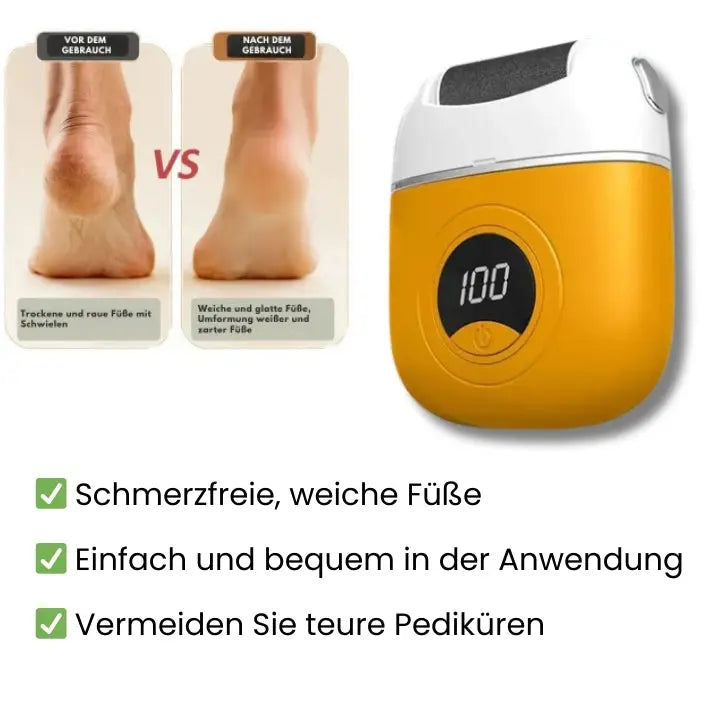 Easy Foot Callus Remover - Befez
