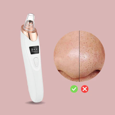 Easy Pore Blackhead Remover Tool for Clear Skin