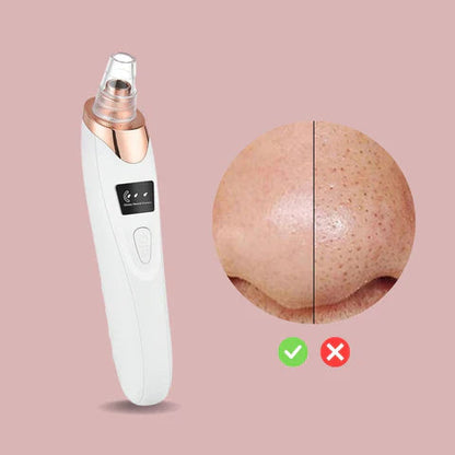 Easy Pore Blackhead Remover Tool for Clear Skin