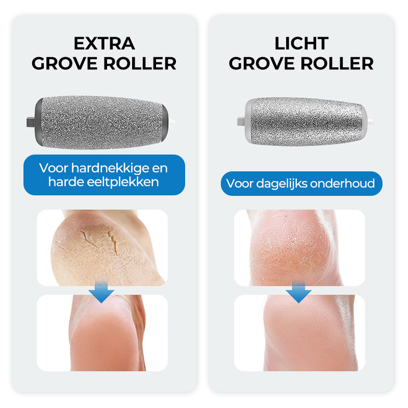 SoftFeet Exfoliator for Smooth Feet