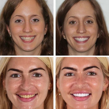 Natural Probiotic Whitening Toothpaste