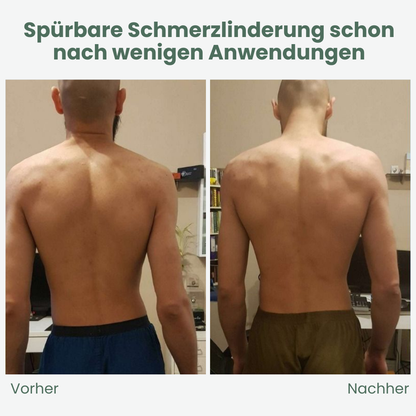 Posture Correcting Back Support Brace
