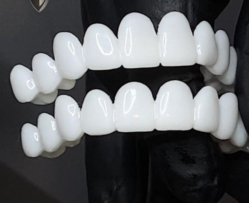 Affordable Custom Dental Implant