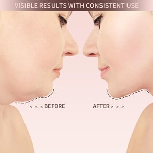 Befez VitaLift - Anti Aging Skin Care