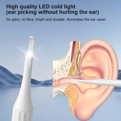 Professional Ear Cleaner Kit with HD Camera