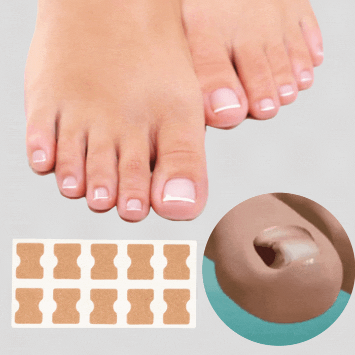 Easy Fit Natural Nail Patches - Befez