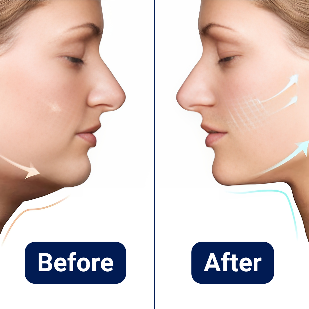 Sleek Face Slimming Massager for Chin Fat Reduction