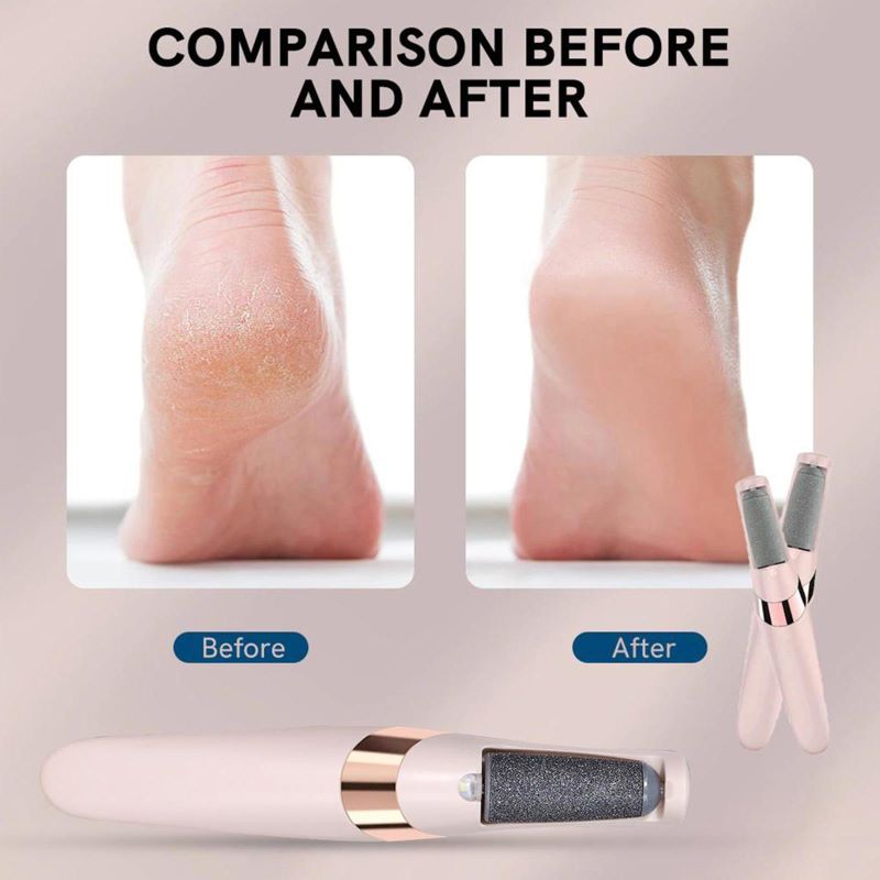 Effective Foot Callus Remover Tool Befez