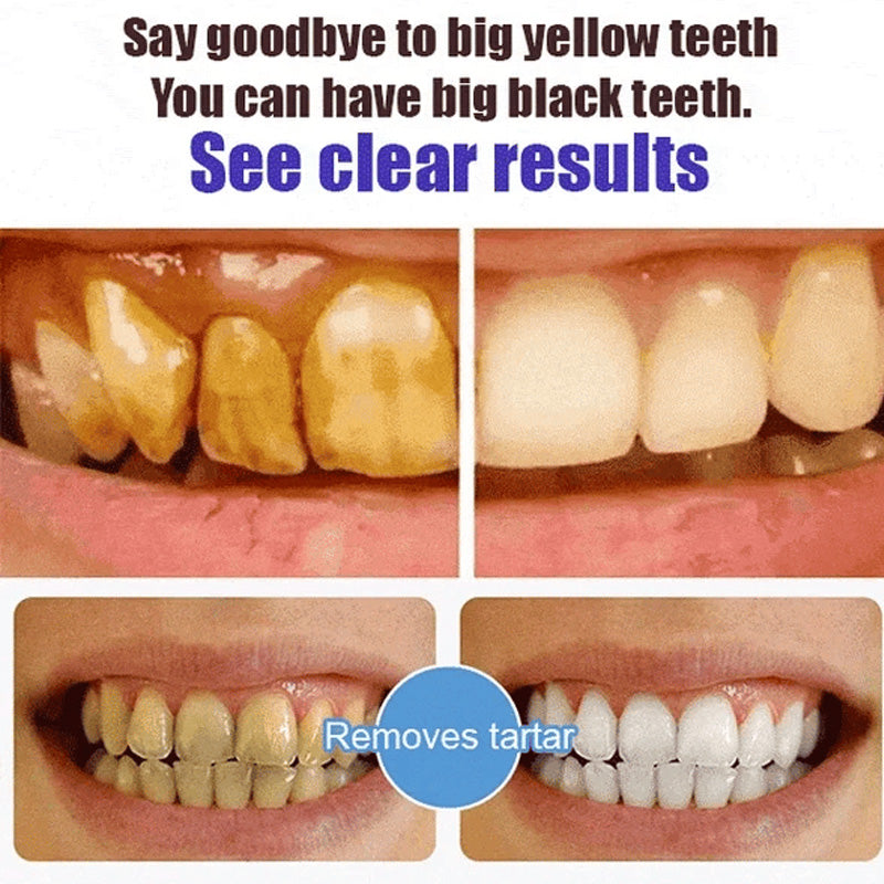 Natural Probiotic Whitening Toothpaste