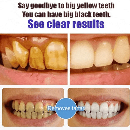 Natural Probiotic Whitening Toothpaste