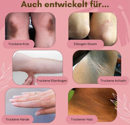 Fast Healing Foot Cream for Dry Itchy Feet