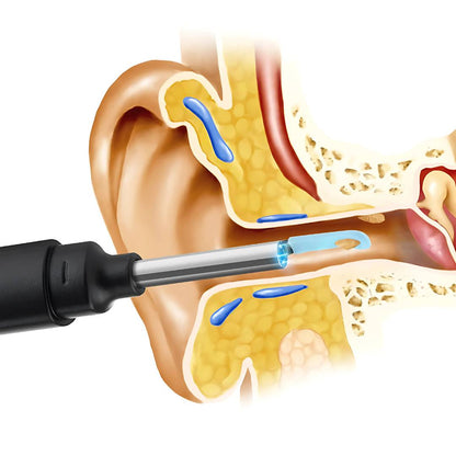 Advanced Ear Cleaner with LED Light and Soft Bristles