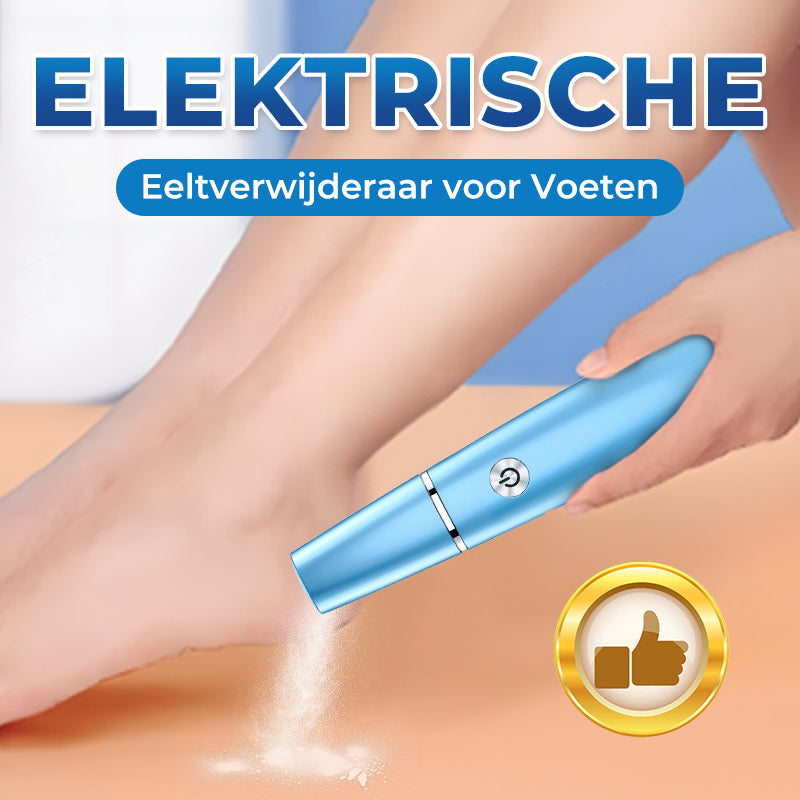 SoftFeet Exfoliator for Smooth Feet