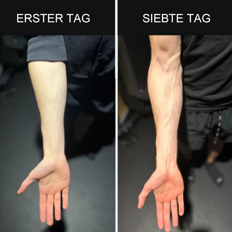 Flexible Finger Stretching Trainer