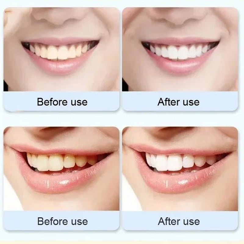 Natural Probiotic Whitening Toothpaste