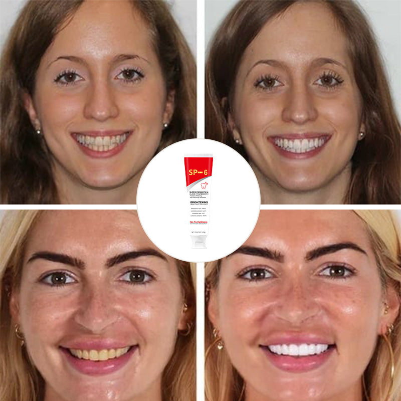 Natural Probiotic Whitening Toothpaste