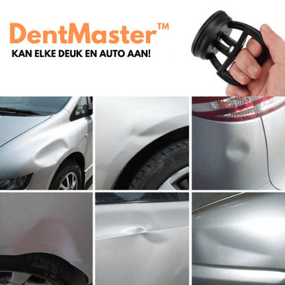 Advanced Car Dent Repair Kit - Befez