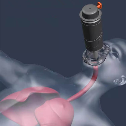 Easy Use Choke Rescue Device