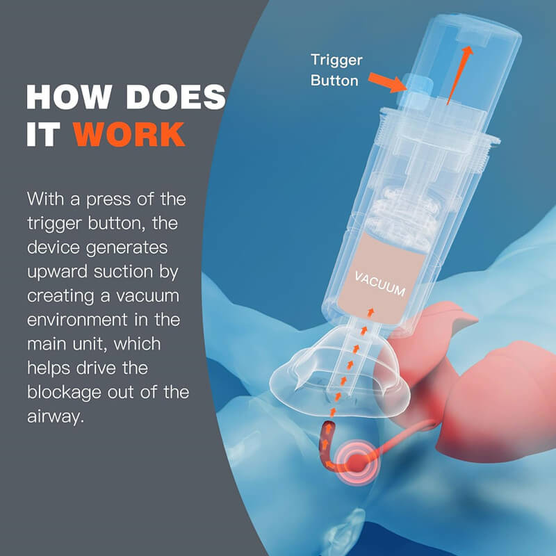 Easy Use Choke Rescue Device