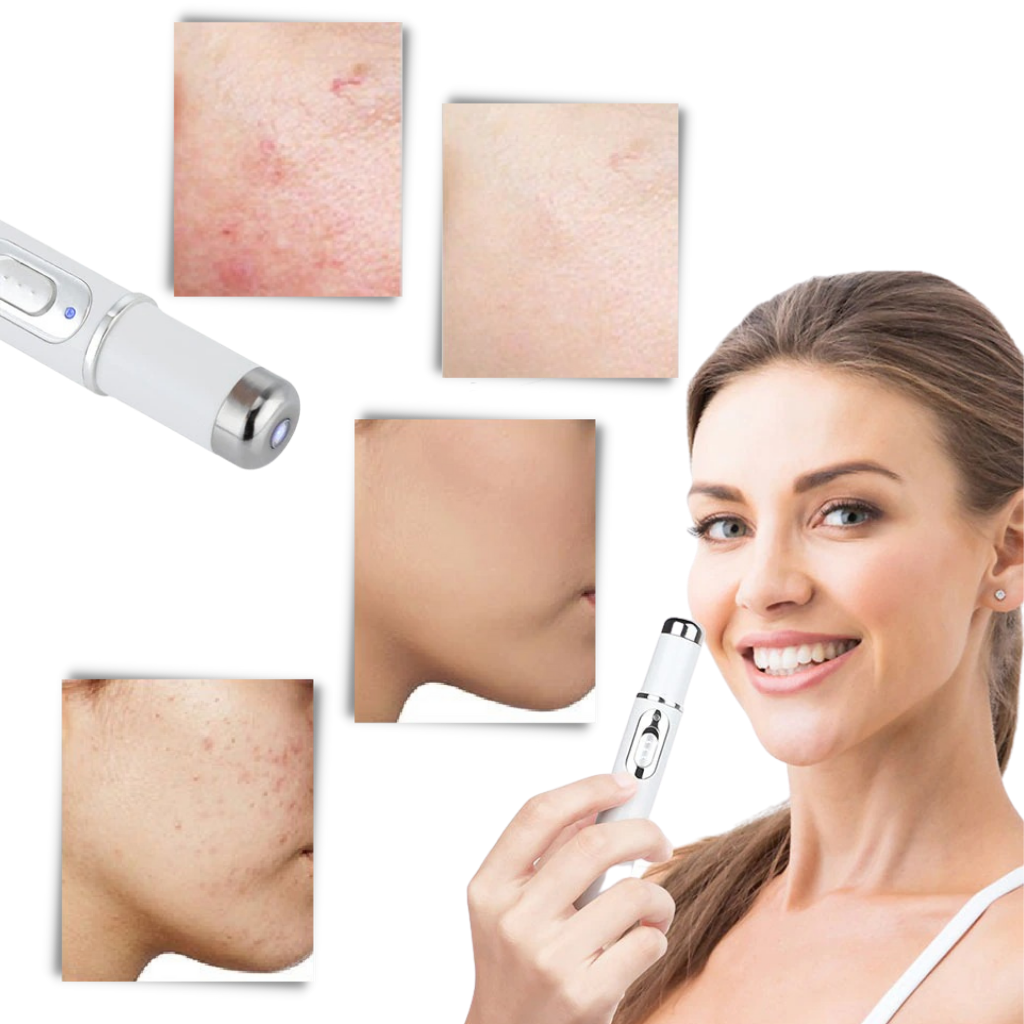 Portable Anti Aging Light Treatment Pen