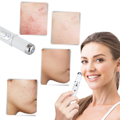 Portable Anti Aging Light Treatment Pen