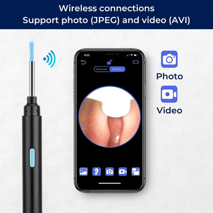 Advanced Ear Cleaner with LED Light and Soft Bristles