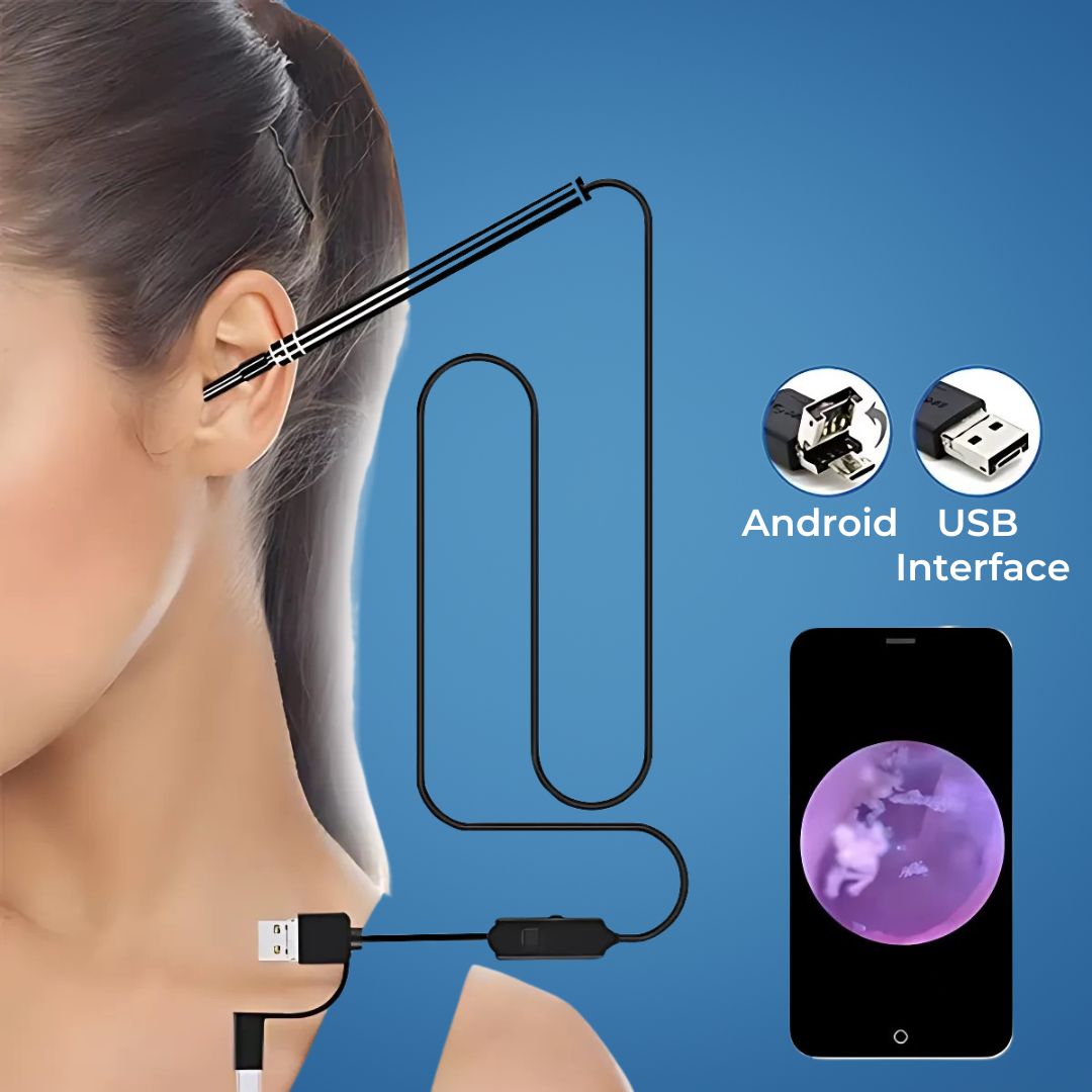 Advanced Ear Scope with HD Camera and Wax Removal - Befez