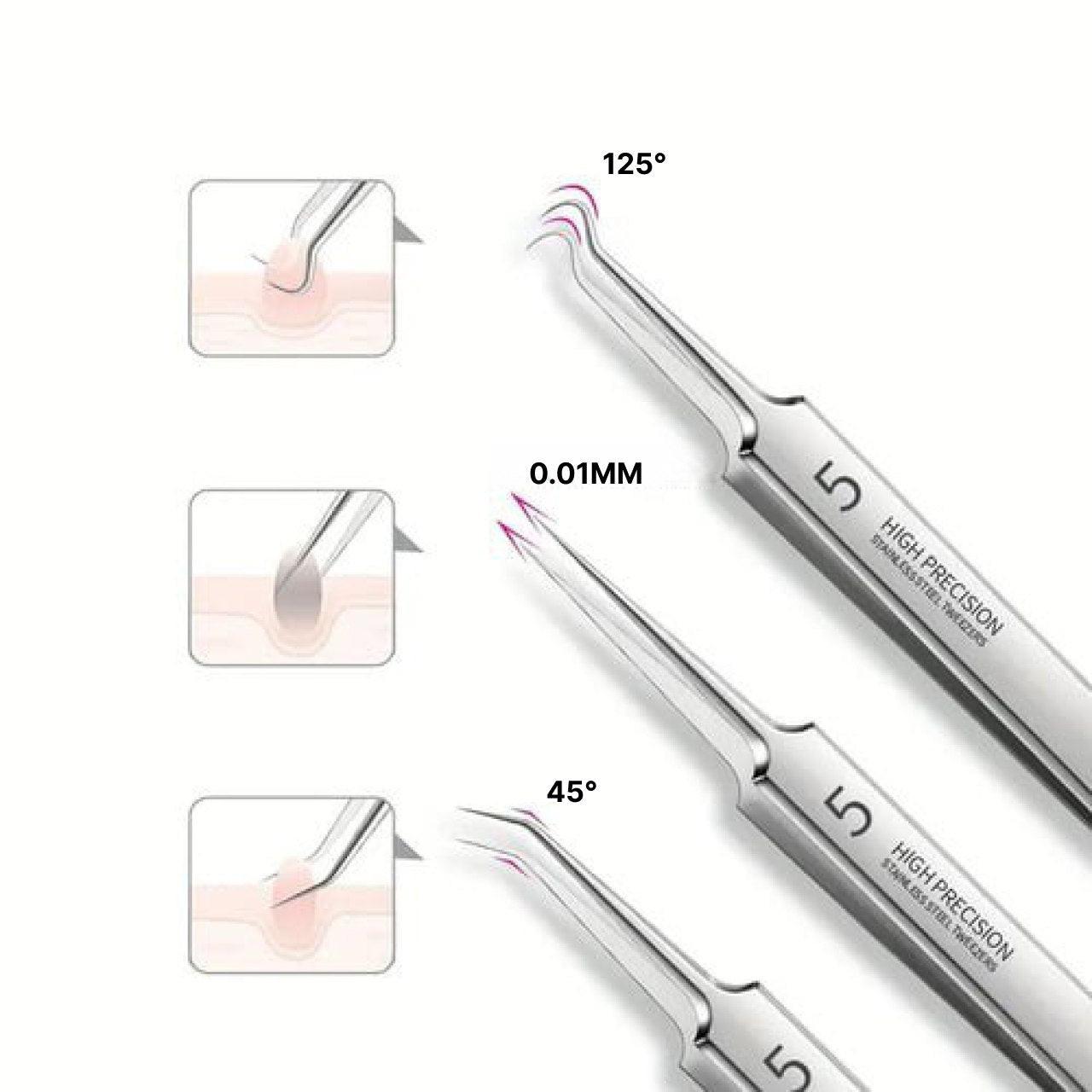 Acne Removal Tool - Pimple Extractor Kit - Befez