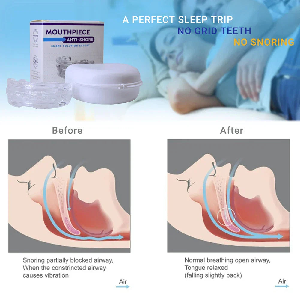 Silent Night Anti Snore Device