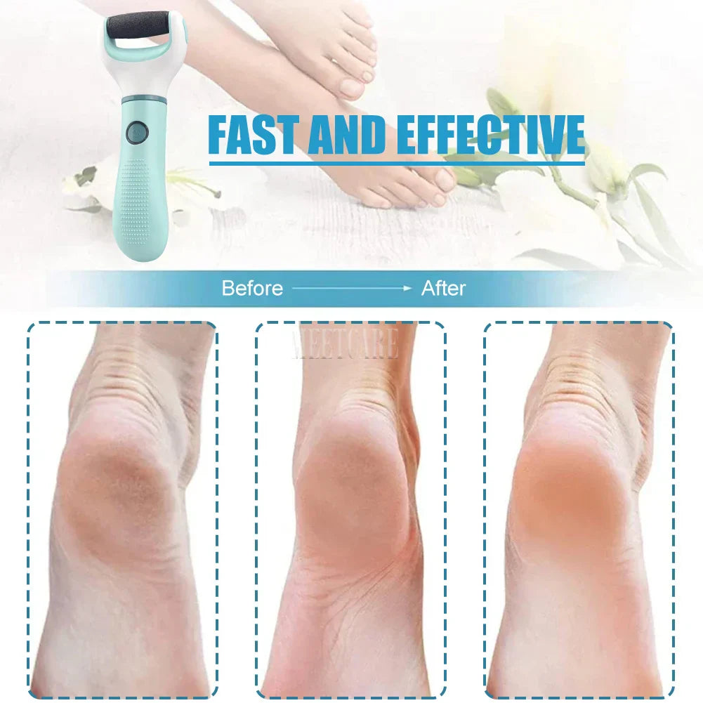 Easy Foot Callus Remover with USB Recharge
