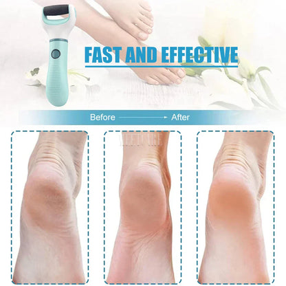 Easy Foot Callus Remover with USB Recharge
