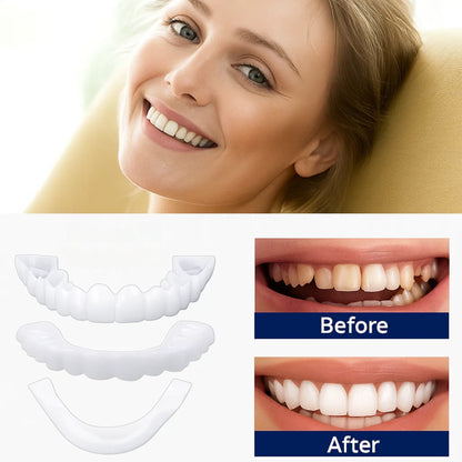 Slim Clip-On Veneers for Adults