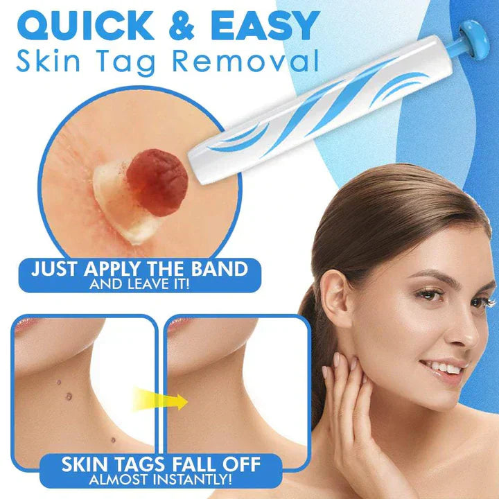 Easy Peel Removal Kit