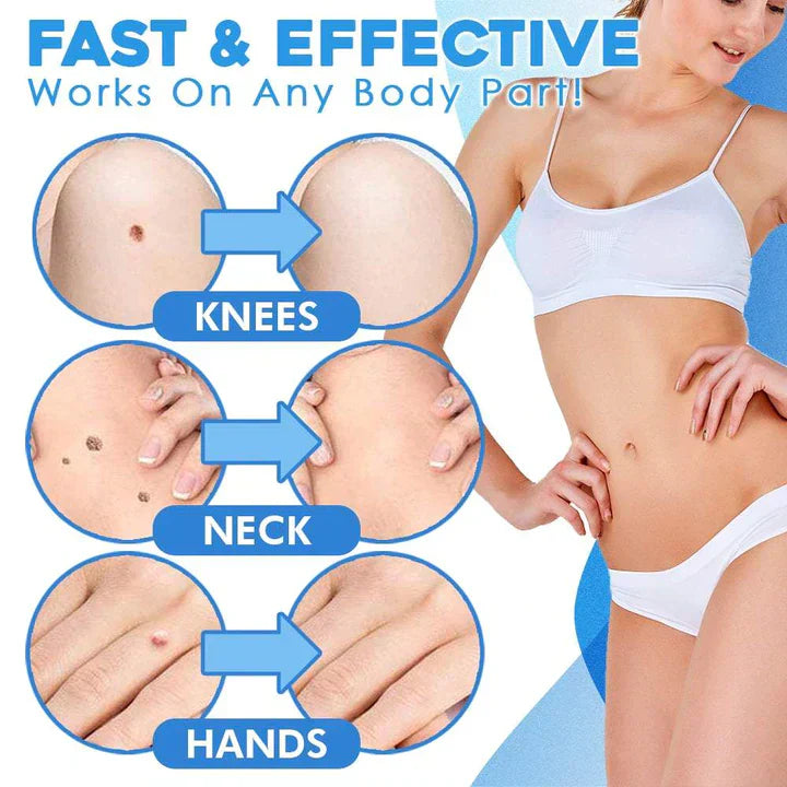Easy Peel Removal Kit