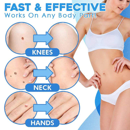 Easy Peel Removal Kit