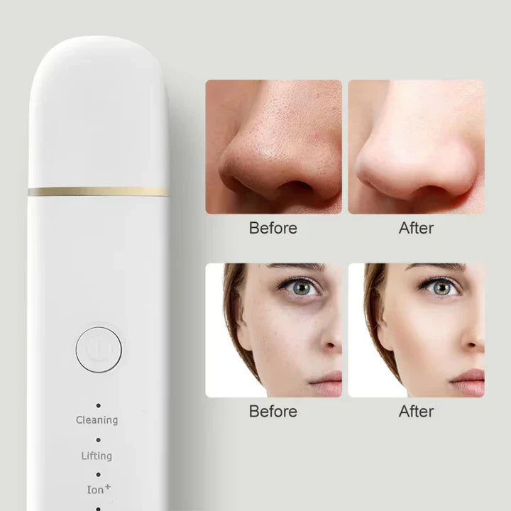 Exfoliating Face Brush for Deep Clean Skin