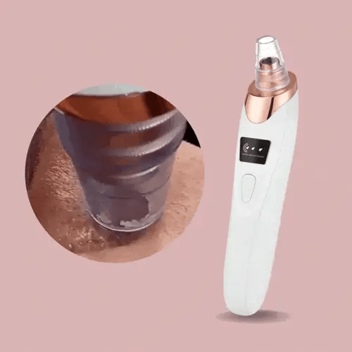 Easy Pore Blackhead Remover Tool for Clear Skin - Befez